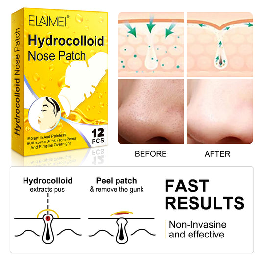 Hydrocolloid Blackhead Acne Removing Nose Paste Pore Cleansing White Head Nose Mask Mild And Does Not Hurt Skin 12pcs