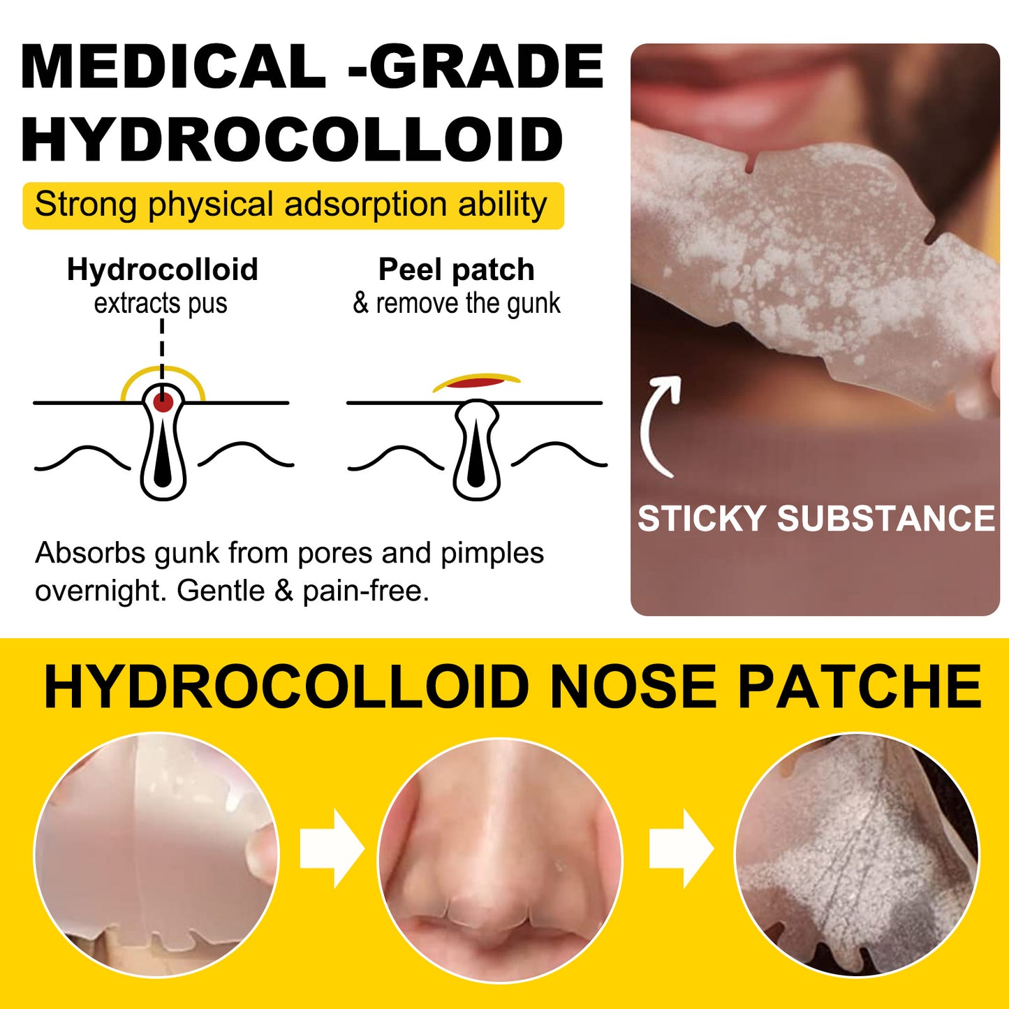 Hydrocolloid Blackhead Acne Removing Nose Paste Pore Cleansing White Head Nose Mask Mild And Does Not Hurt Skin 12pcs