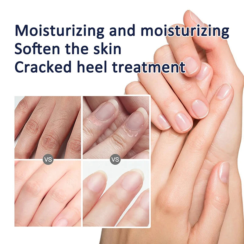 Vitamin E Hand Cream Moisturizing Anti Cracking Nourishing Anti-drying Wrinkle Removal Hand Skin Care Cracked Repair Cosmetics