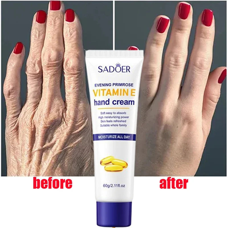 Vitamin E Hand Cream Moisturizing Anti Cracking Nourishing Anti-drying Wrinkle Removal Hand Skin Care Cracked Repair Cosmetics