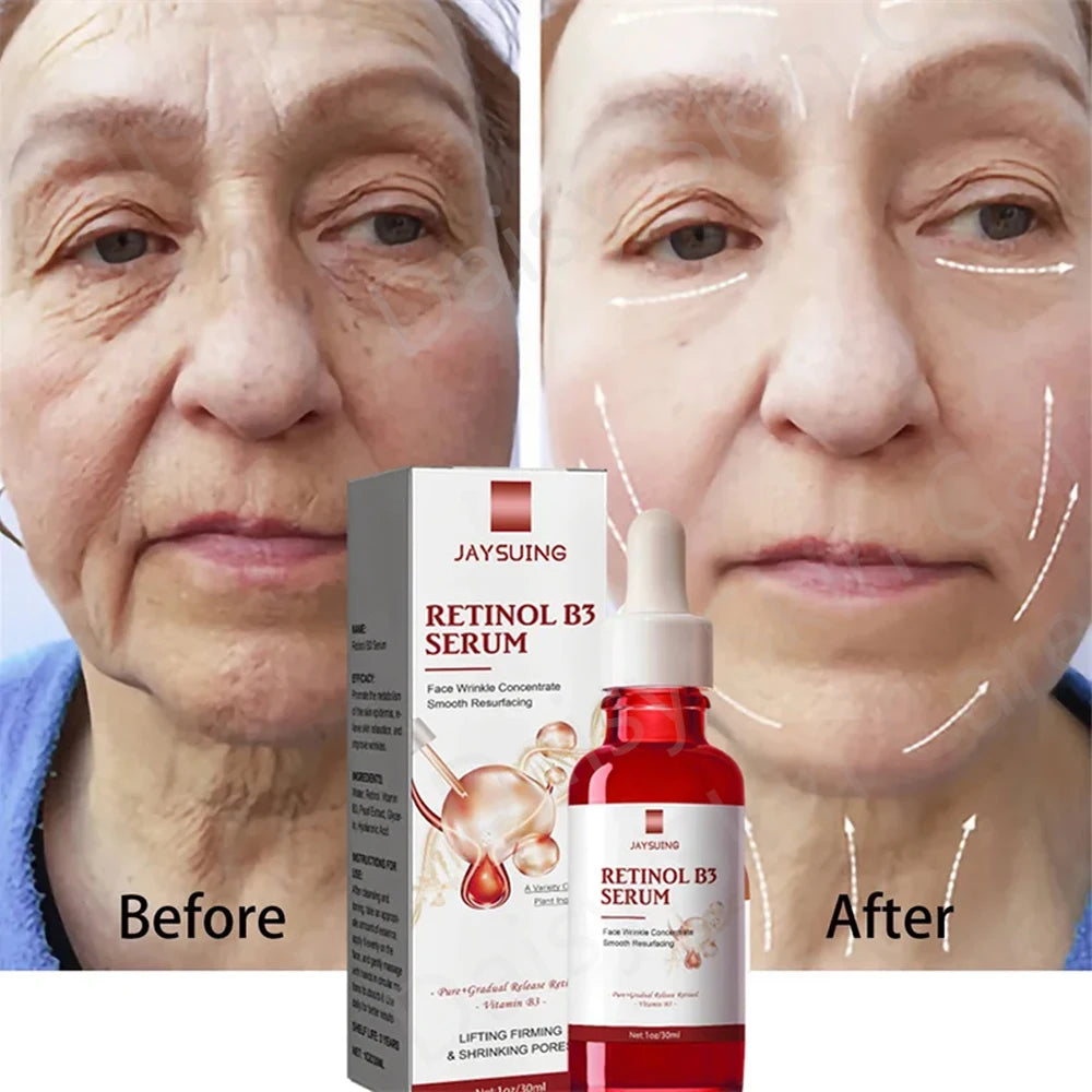 Retinol Wrinkle Remover Face Serum Instant Firming Lifting Anti-Aging Liquid Fade Fine Lines Whitening Nourish Skin Care Product