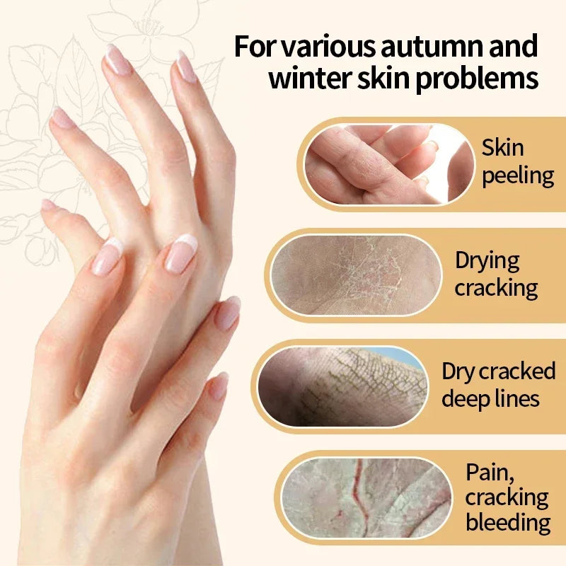 Vitamin E Hand Cream Moisturizing Anti Cracking Nourishing Anti-drying Wrinkle Removal Hand Skin Care Cracked Repair Cosmetics